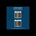 Ducray Kelual Ds İnatçı Kepeğe Karşı Şampuan 100 ml