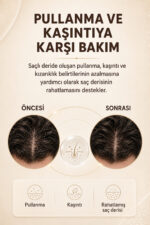 Dermoskin Antreseborr Şampuan 200ml - Görsel 5